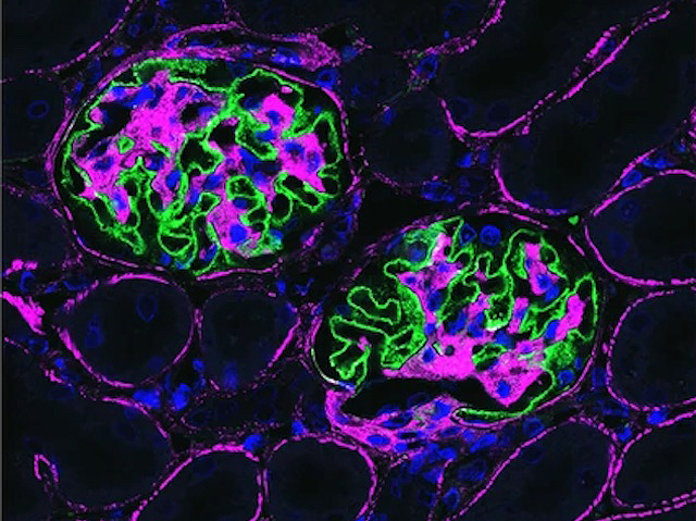 unes estructures circulars (corpuscle renal) que té dins unes cèl·lules marcades i una línia verda entre elles