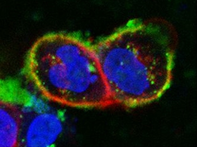 Estructures ovoides amb una coberta externa roja i verda i una gran molècula amorfa blava al seu interior.