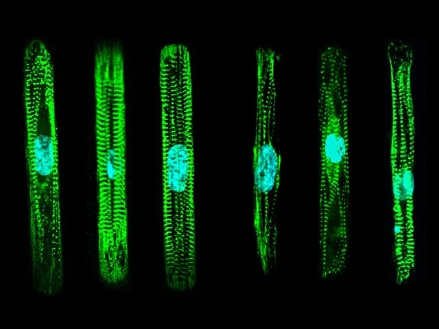 Imatge de microscòpia de fluorescència de cardiomiòcits en verd i els nuclis en blau