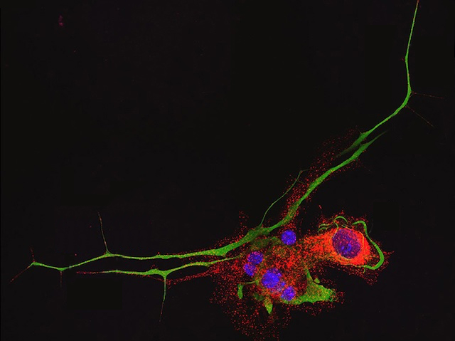 Cèl·lules primàries aïllades dels ganglis de l'arrel dorsal de ratolins adults tenyits per CDK13 i neurofilaments