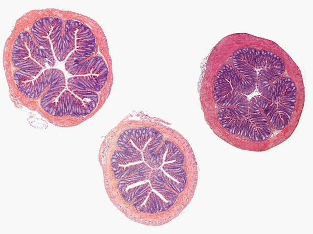 Tres mostres microcòpiques en rosa i morat d'intestí