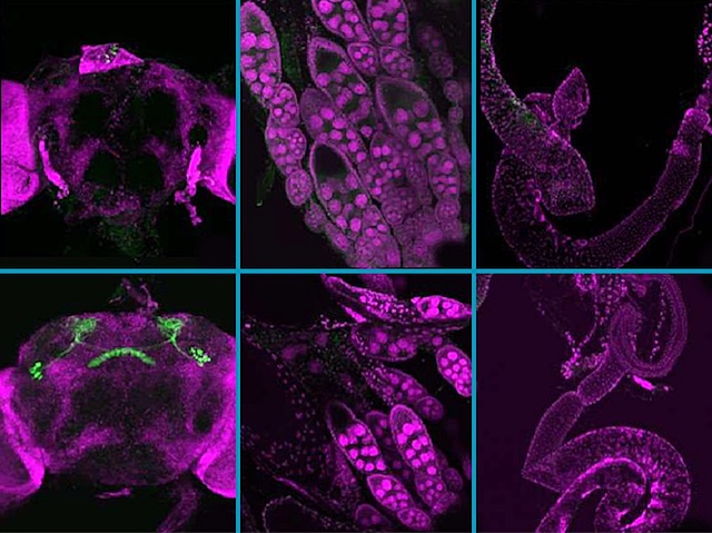 6 panells amb talls resaltats amb fluorescència de cervell, ovaris i intestins