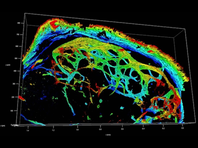 Es veu una reconstrucció en tres dimensions amb una xarxa interconnectada a dins d'una cavitat